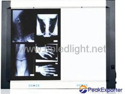 LED x ray film viwer box