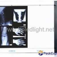 LED x ray film viwer box