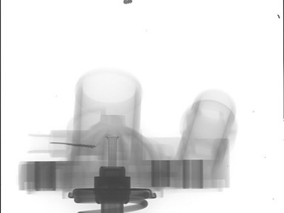 X-ray