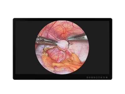 Surgical Monitor with 4K Ultra HD Display